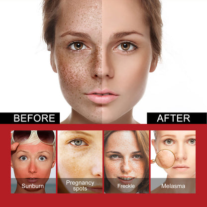 Dark Spots Corrector
