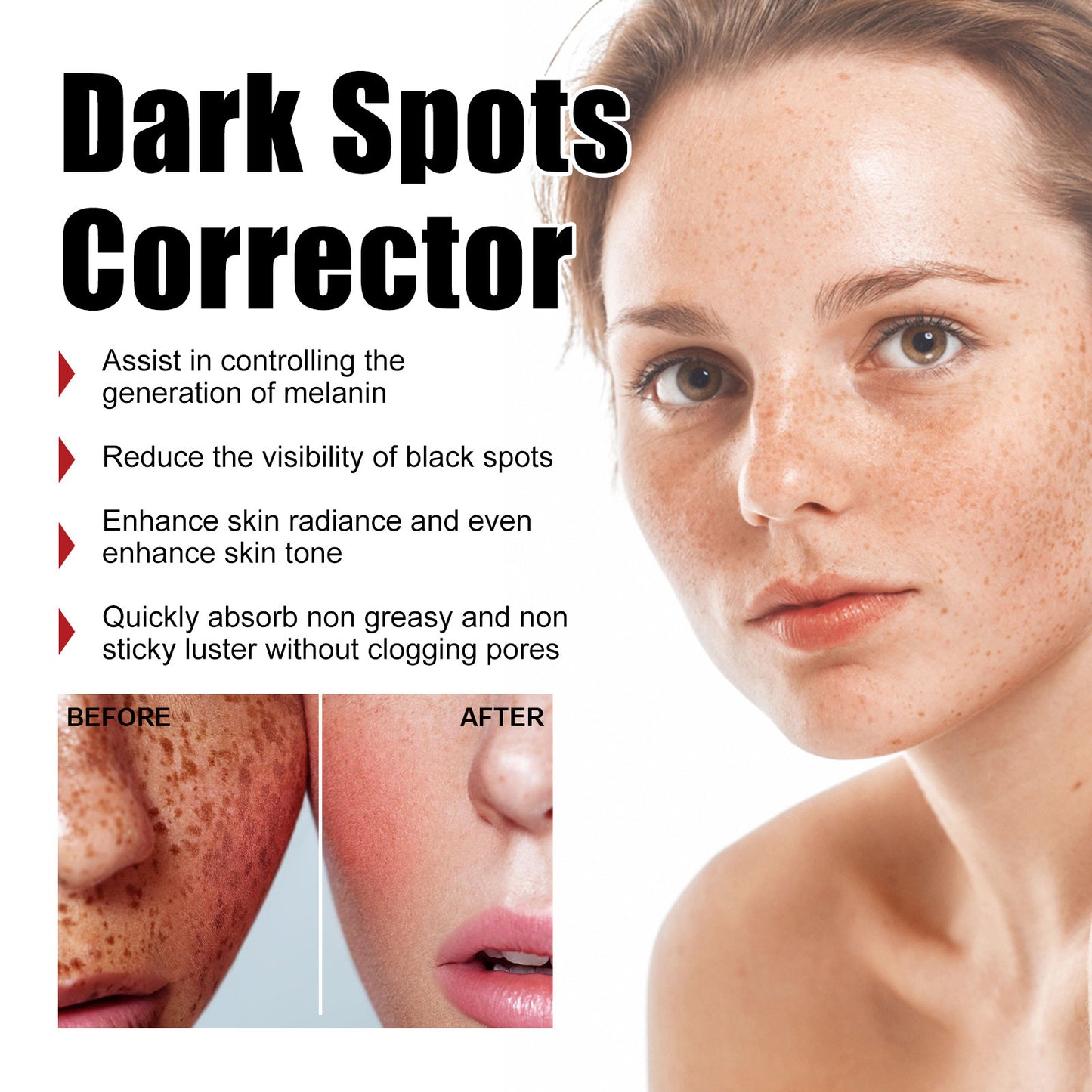 Dark Spots Corrector